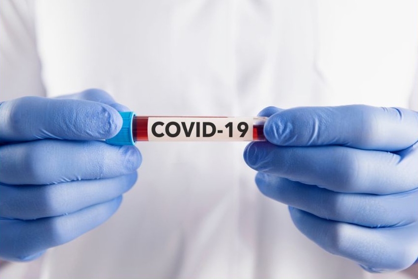 TODOS CONTRA O COVID-19